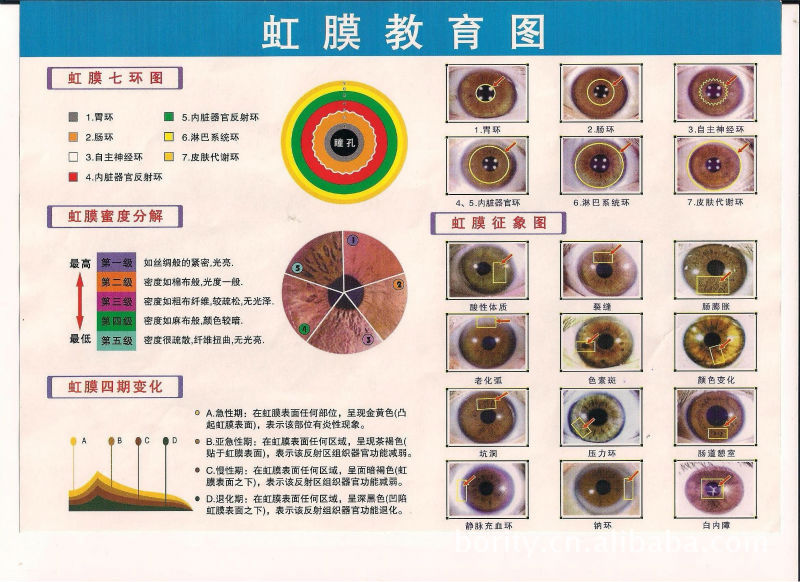 虹膜缺损图片正常人的虹膜图片瞳孔与虹膜粘连图片第6页大山谷图库 