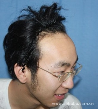 萧蔷的高<em>额头</em>是<em>聪明</em>还是发际线上移- - 阿里巴