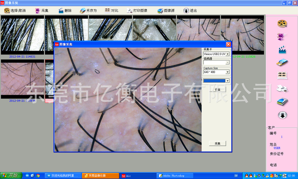 500万像素高清毛发<em>检测</em>仪,<em>头发检测</em>仪,<em>毛囊检</em>