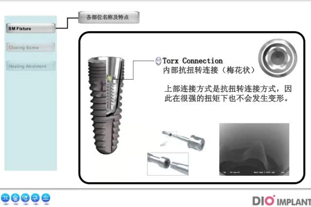 人造器官及植入体-口腔种植体 韩国DIO(SM植体) 种植牙-人造器官及植入体