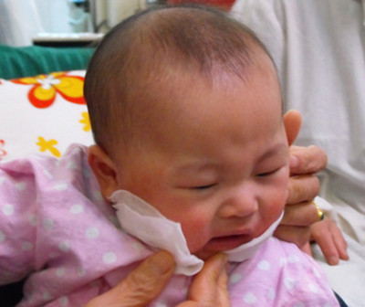 小孩湿疹家庭用药 - 阿里巴巴专栏