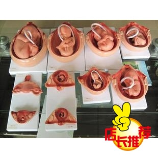 【178CM针灸人体模型(带人体针灸)肌肉半边深圳制冷设备能达卓有限公司图片