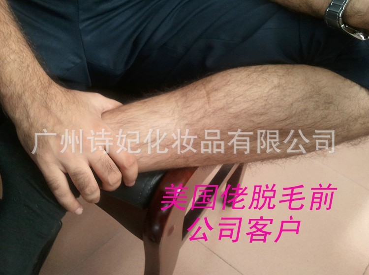 蜡纸脱毛效果1