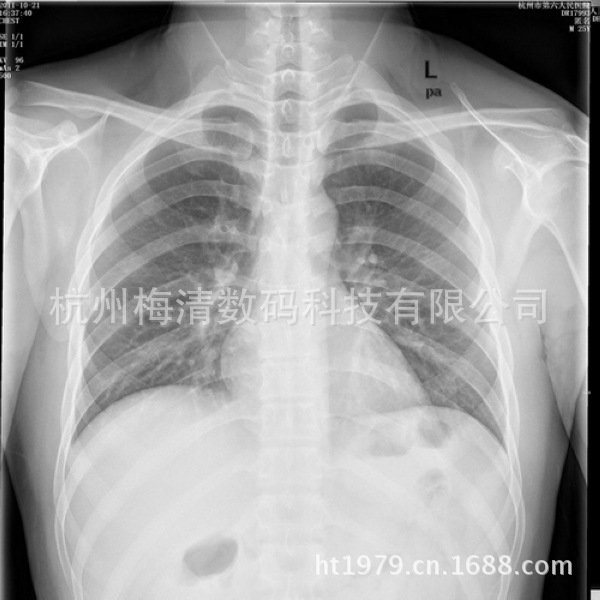 胶片、胶卷-富士同款 国产干式医用胶片-胶片、