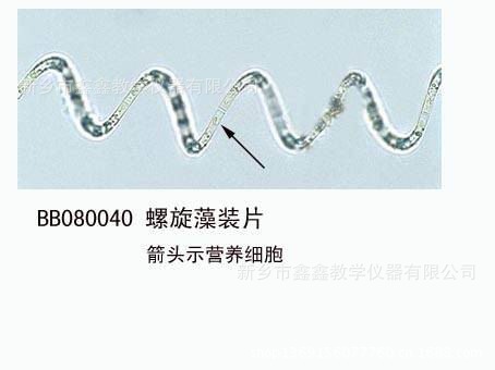 Spyrogyra with chloroplas w.m.