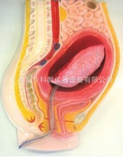医药教学器材-胎盘剥离模型医学模型-医药教学