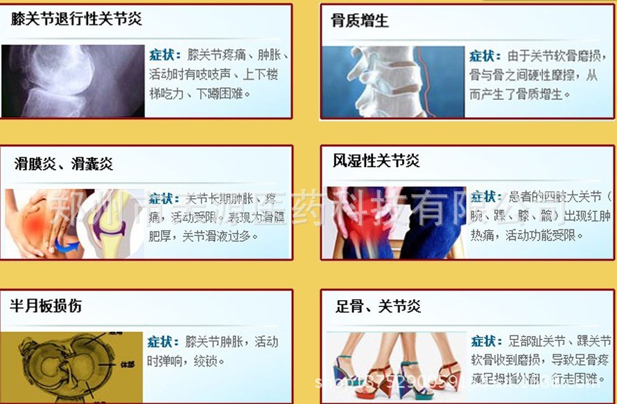 各種風濕骨病的癥狀