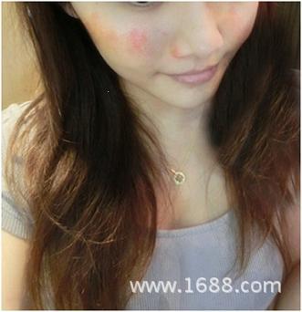 季节性过敏吃什么药,诺美康脱敏疗效不错! - 阿