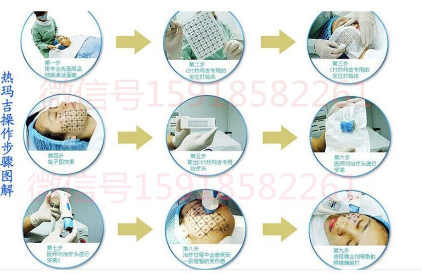 韓國塑美極操作步驟