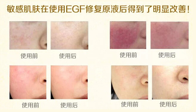 莹润活肤EGF原液加工|EGF精华修复原液OEM