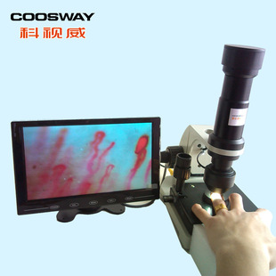 显微镜-厂家直供 血液微循环检测仪 400倍放大