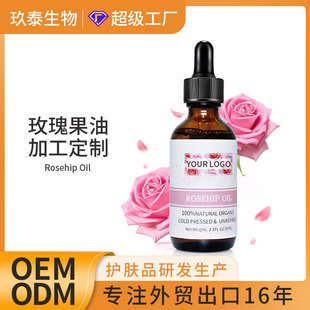 OEMեõRosehip Oilowspa沿wĦA