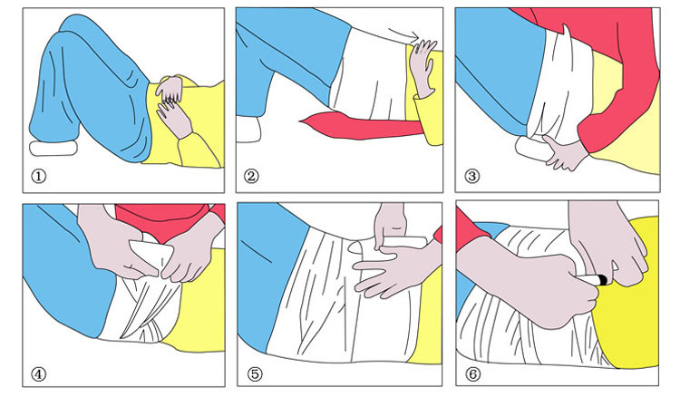 腹部包扎法图片