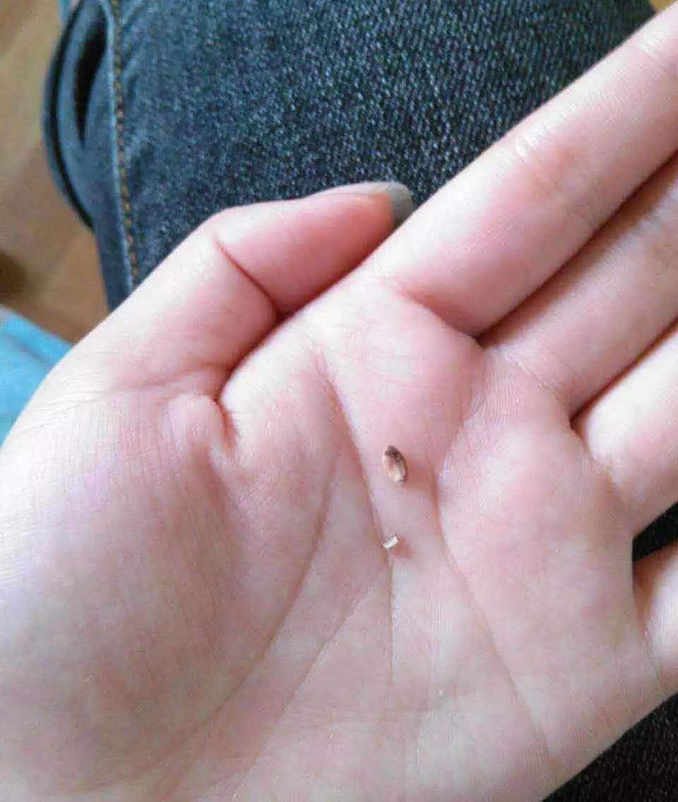 益齿洁代理的牙结石都刷掉下来了,坚持使用,给你意想不到惊喜